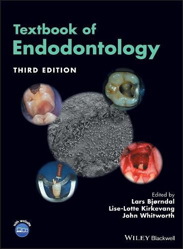 Cover image for Textbook of Endodontology 3e