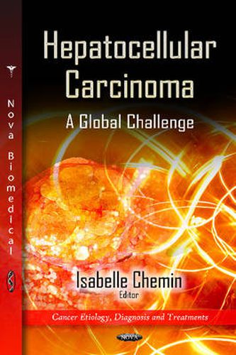 Cover image for Hepatocellular Carcinoma: A Global Challenge