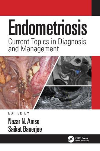 Cover image for Endometriosis: Current Topics in Diagnosis and Management