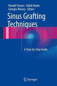 Cover image for Sinus Grafting Techniques: A Step-by-Step Guide