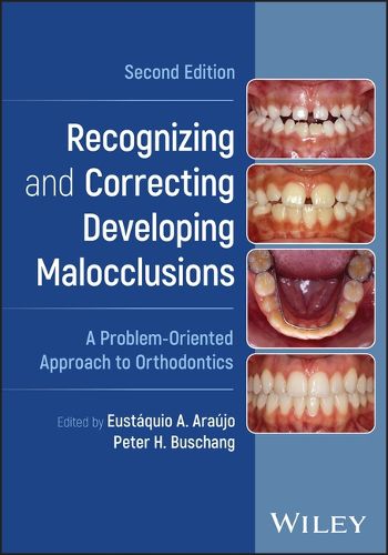 Recognizing and Correcting Developing Malocclusions