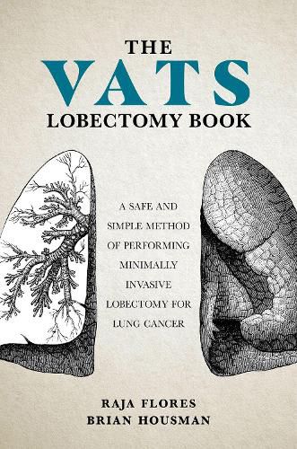 The VATS Lobectomy Book