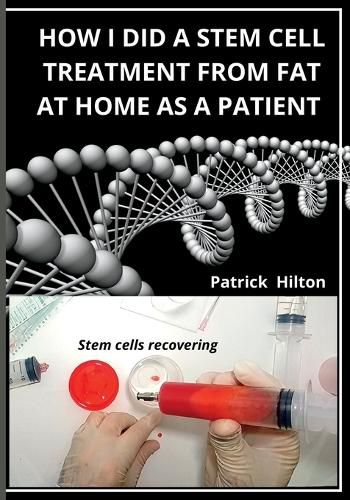 Cover image for How I Did a Stem Cell Treatment From Fat at Home as a Patient
