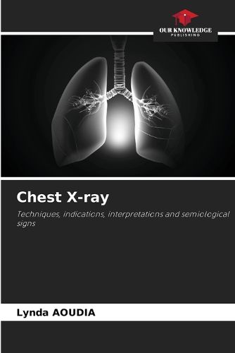 Cover image for Chest X-ray