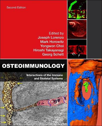 Cover image for Osteoimmunology: Interactions of the Immune and Skeletal Systems