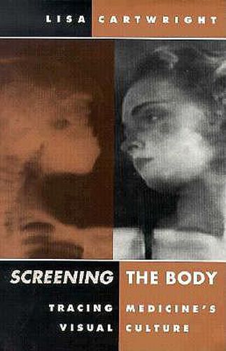 Cover image for Screening The Body: Tracing Medicine's Visual Culture
