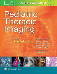 Cover image for Pediatric Thoracic Imaging