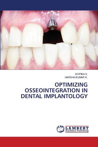 Cover image for Optimizing Osseointegration in Dental Implantology