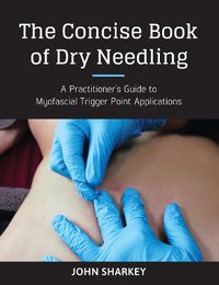 Cover image for The Concise Book of Dry Needling: A Practitioner's Guide to Myofascial Trigger Point Applications