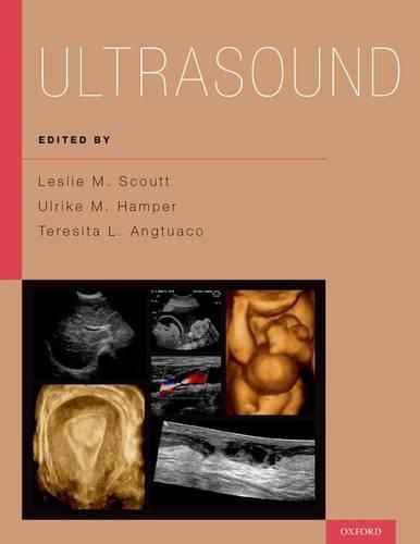 Cover image for Ultrasound