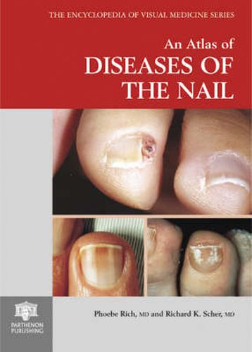 Cover image for An Atlas of Diseases of the Nail