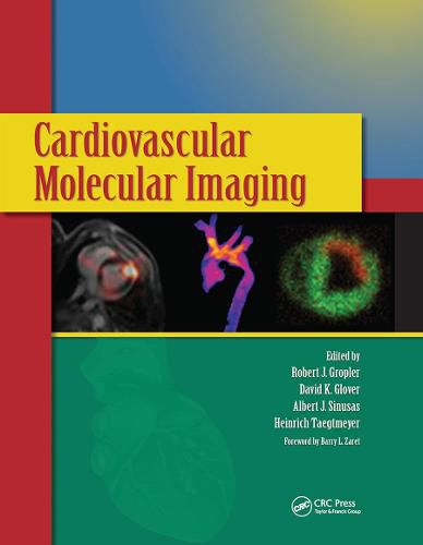 Cardiovascular Molecular Imaging