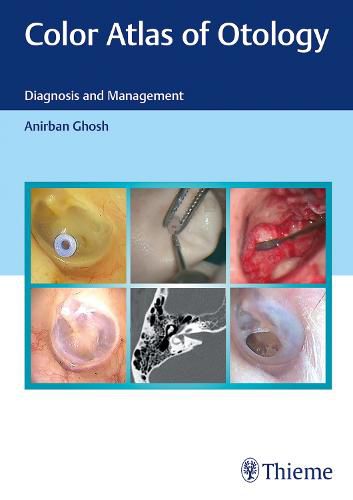 Cover image for Color Atlas of Otology