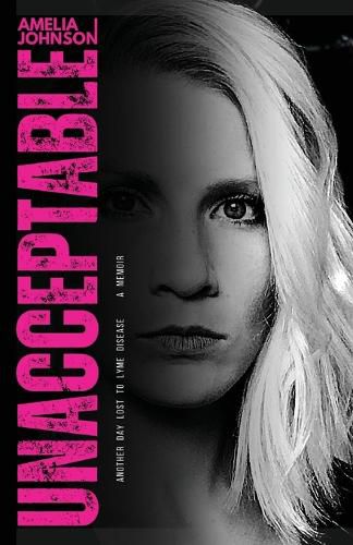 Cover image for Unacceptable