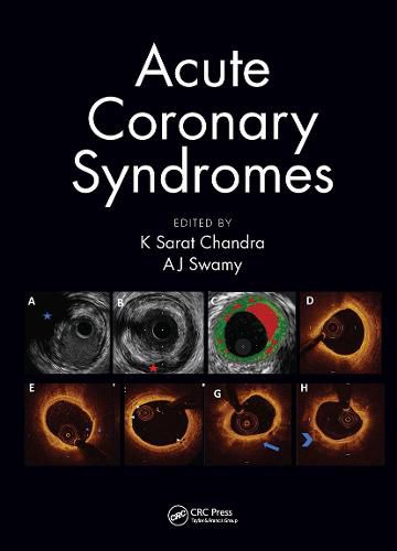 Cover image for Acute Coronary Syndromes