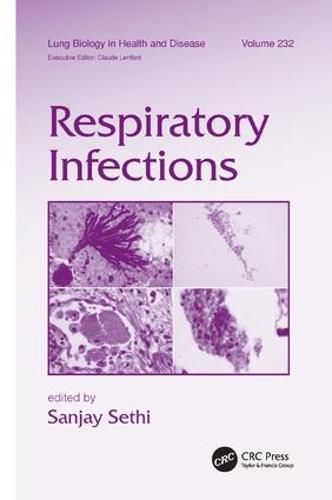 Cover image for Respiratory Infections