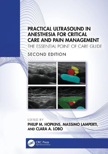 Cover image for Practical Ultrasound in Anesthesia for Critical Care and Pain Management