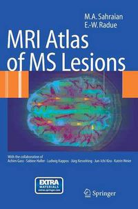 Cover image for MRI Atlas of MS Lesions