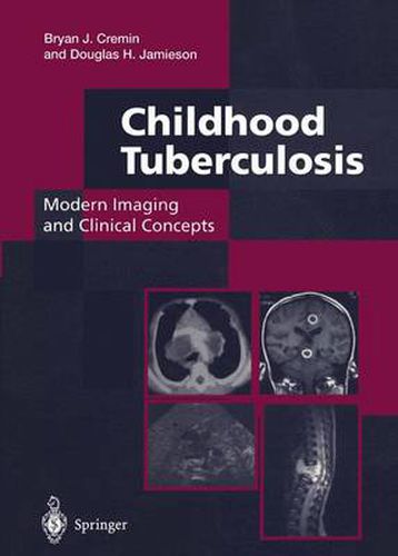 Cover image for Childhood Tuberculosis: Modern Imaging and Clinical Concepts