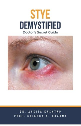 Stye Demystified