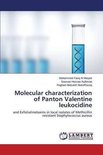 Molecular characterization of Panton Valentine leukocidine