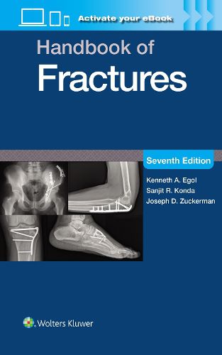 Cover image for Handbook of Fractures: Print + eBook with Multimedia