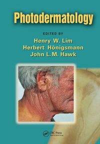 Cover image for Photodermatology
