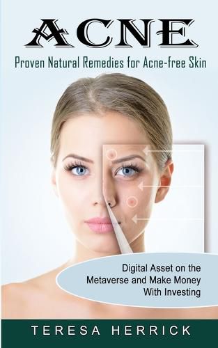 Cover image for Acne: Proven Natural Remedies for Acne-free Skin (Learn About the Most Recent Updated Natural Acne)