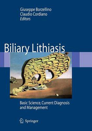 Cover image for Biliary Lithiasis: Basic Science, Current Diagnosis and Management