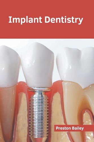 Cover image for Implant Dentistry