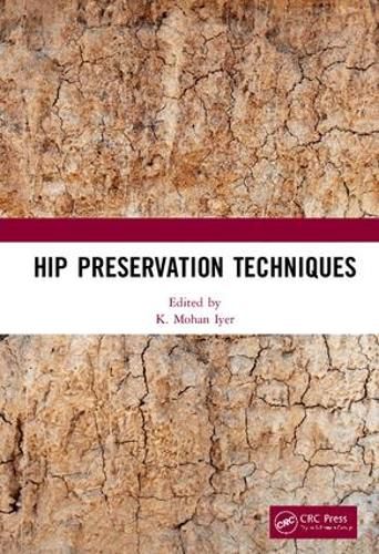 Cover image for Hip Preservation Techniques