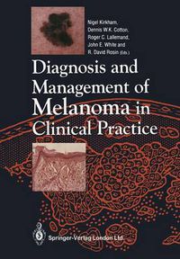 Cover image for Diagnosis and Management of Melanoma in Clinical Practice