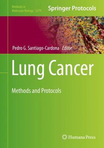 Cover image for Lung Cancer: Methods and Protocols