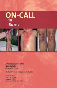 Cover image for On-Call in Burns