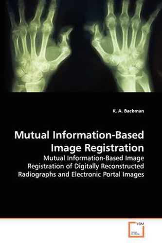 Cover image for Mutual Information-Based Image Registration