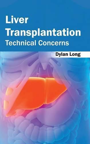 Cover image for Liver Transplantation: Technical Concerns