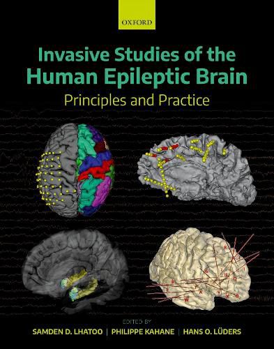 Cover image for Invasive Studies of the Human Epileptic Brain: Principles and Practice