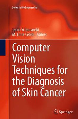 Cover image for Computer Vision Techniques for the Diagnosis of Skin Cancer