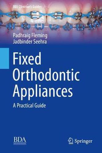 Cover image for Fixed Orthodontic Appliances: A Practical Guide