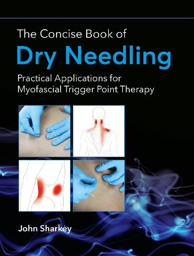 The Concise Book of Dry Needling: A Practitioner's Guide to Myofascial Trigger Point Applications