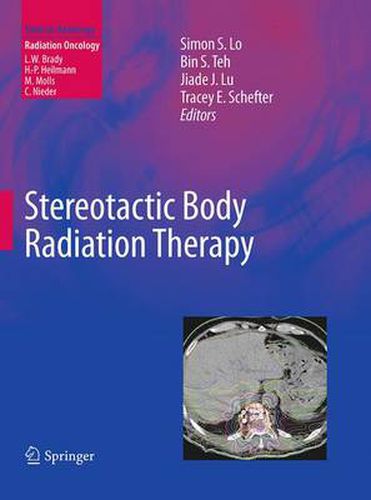 Stereotactic Body Radiation Therapy