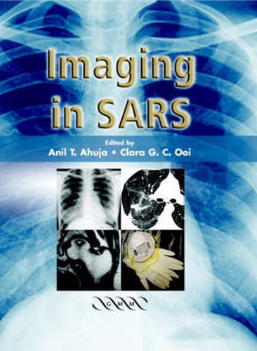 Cover image for Imaging in SARS