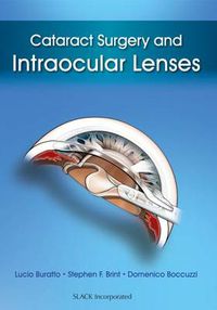 Cover image for Cataract Surgery and Intraocular Lenses