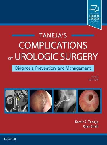 Cover image for Complications of Urologic Surgery: Prevention and Management