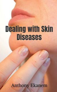 Cover image for Dealing with Skin Diseases