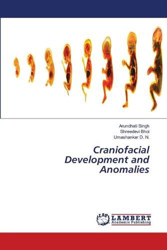Cover image for Craniofacial Development and Anomalies