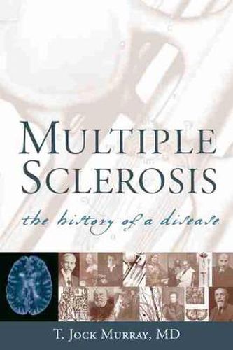 Cover image for Multiple Sclerosis: The History of a Disease