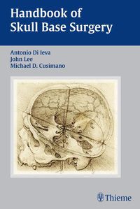 Cover image for Handbook of Skull Base Surgery