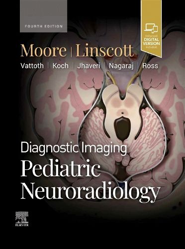 Cover image for Diagnostic Imaging: Pediatric Neuroradiology