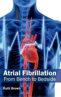 Cover image for Atrial Fibrillation: From Bench to Bedside